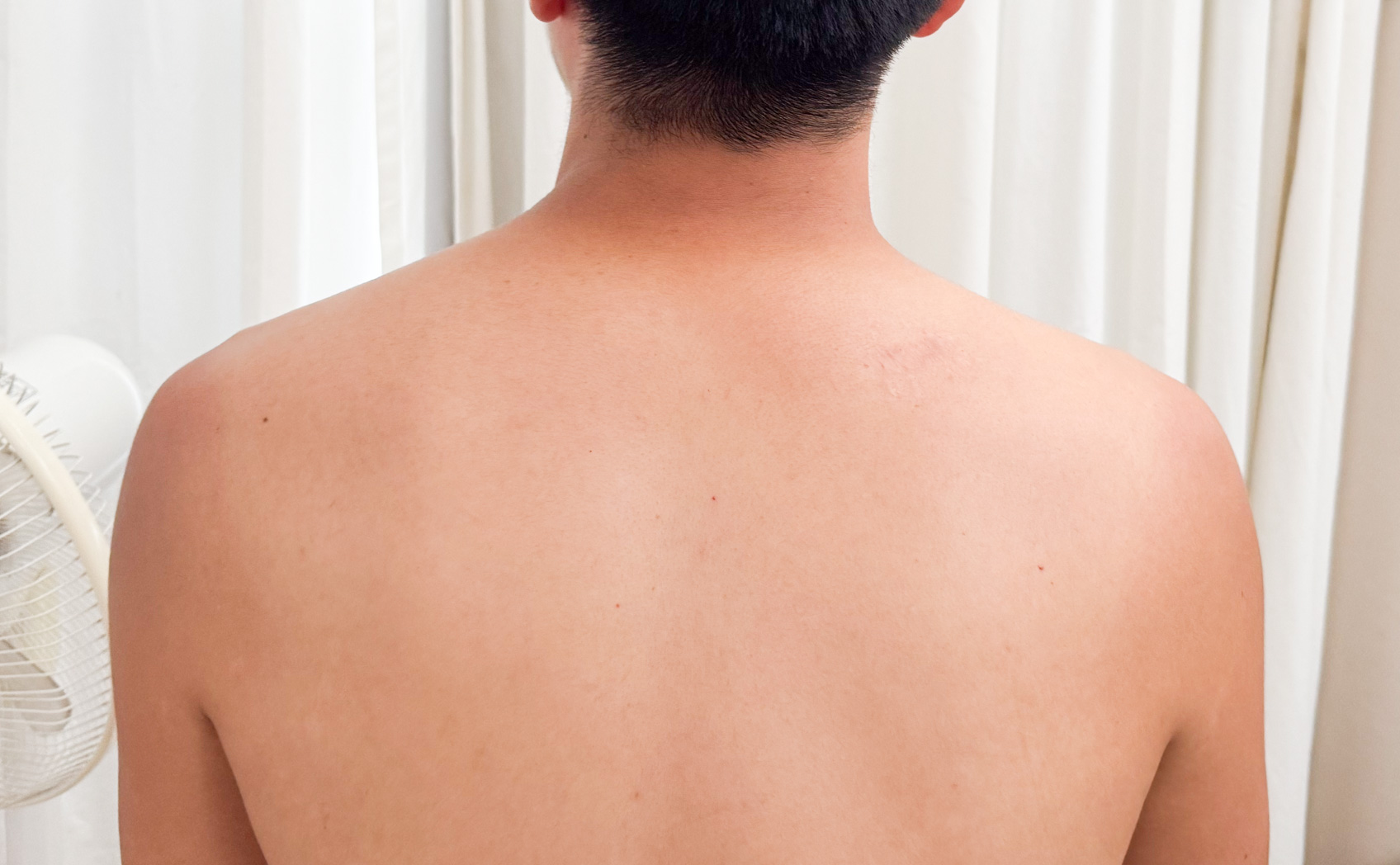 肌にカッティングシートは貼れるのか。そして日焼け跡はできるのかの実験