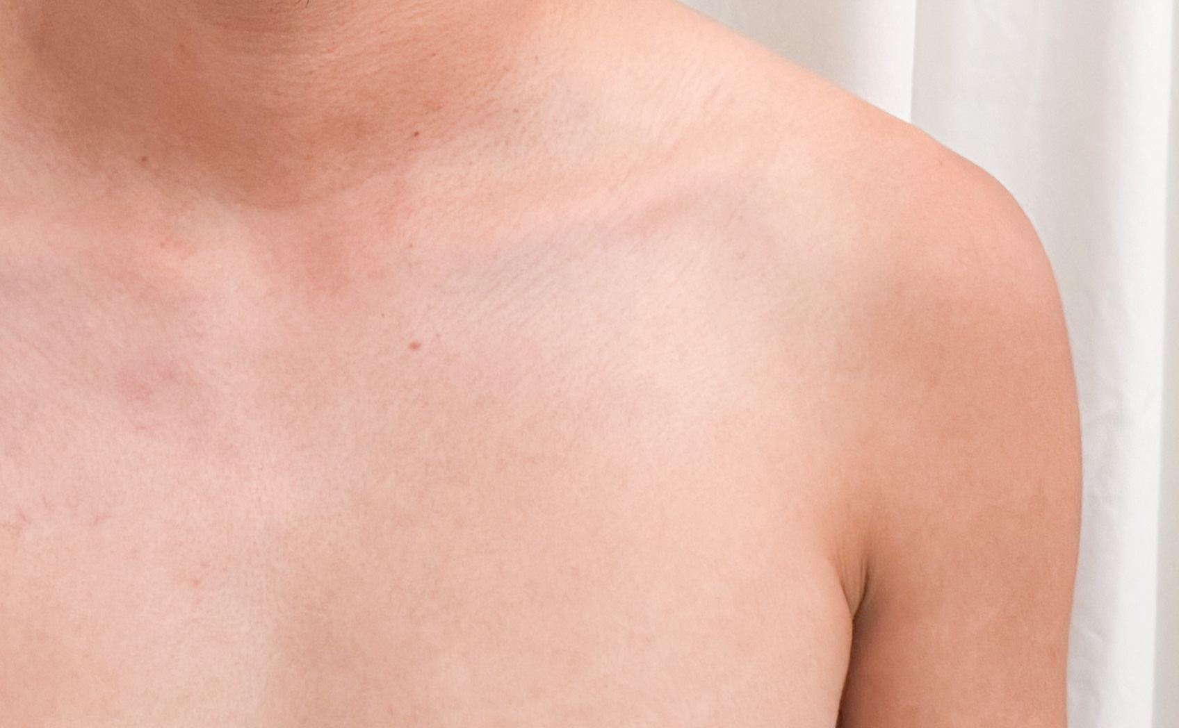 肌にカッティングシートは貼れるのか。そして日焼け跡はできるのかの実験