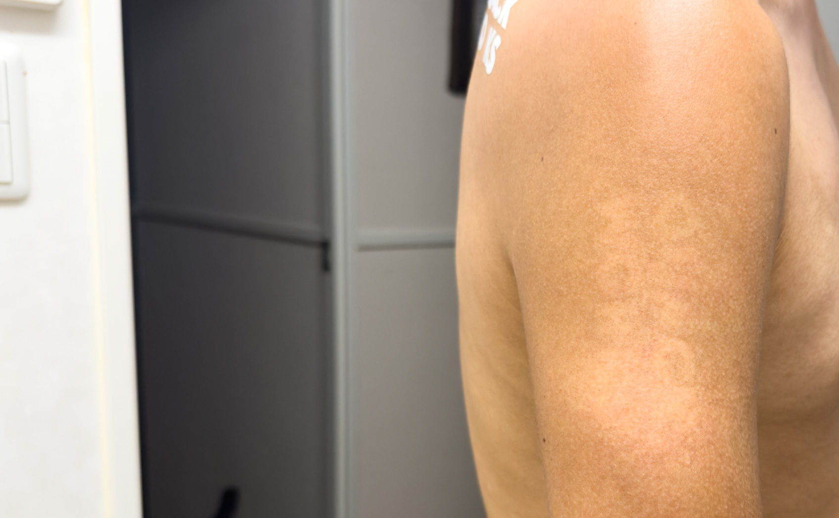 肌にカッティングシートは貼れるのか。そして日焼け跡はできるのかの実験